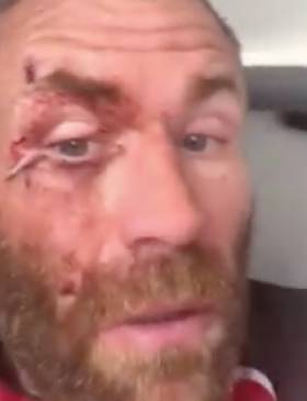 Damian Browne shows his injuries. 